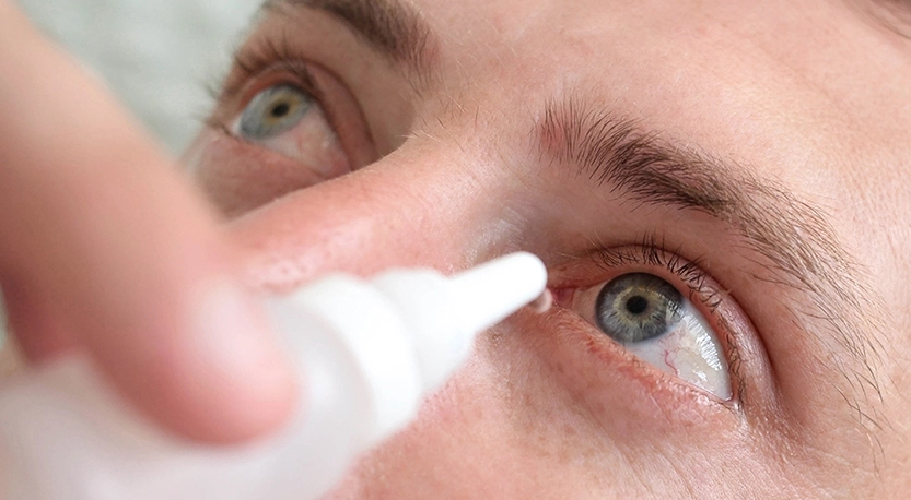 Göz Kuruluğu Olanlar İçin Özel Lens Türleri ve Öneriler