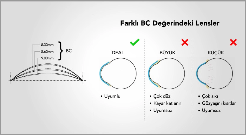 Kontakt Lenslerde Çap Önemli Midir