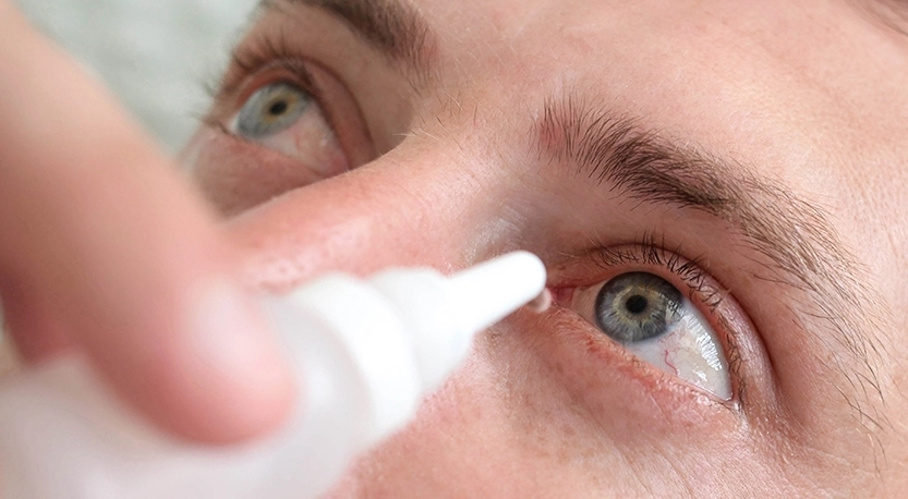 Göz Damlası ve Lens Uyumu İçin Uzman Tavsiyeleri